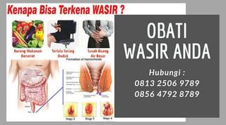 Illustration for article titled bagaimana cara menghilangkan ambeien secara alami